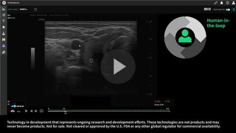 thumbnail for player SonoSAMTrack¹: A Pioneering Research Analysis of Ultrasound Imaging with AI